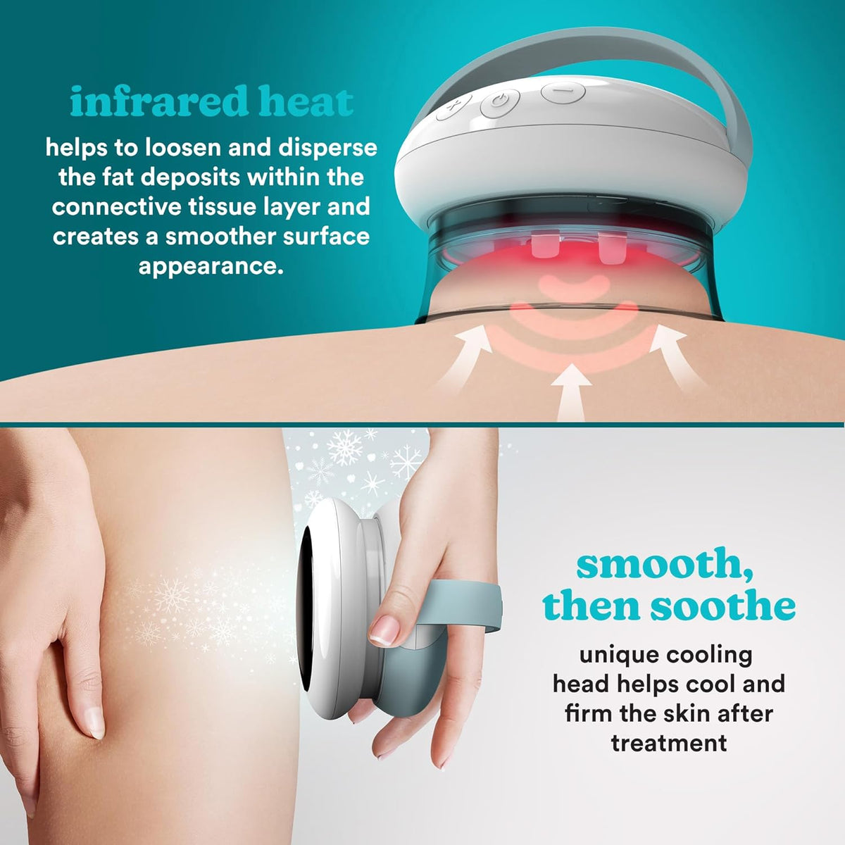 Homedics Skin Smoothee Elektrisches Vakuum-Schröpfgerät - Anti-Cellulite-Massagegerät Um Die Haut Zu Straffen, Mit 3 Austauschbaren Schröpfgläsern, Infrarotwärme Und Beruhigender Kälteoption